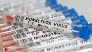 La Norvège est prête à faire face à la mpox (ministère) La Norvège est prête à faire face à la mpox (ministère)